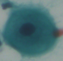 pap smear AI