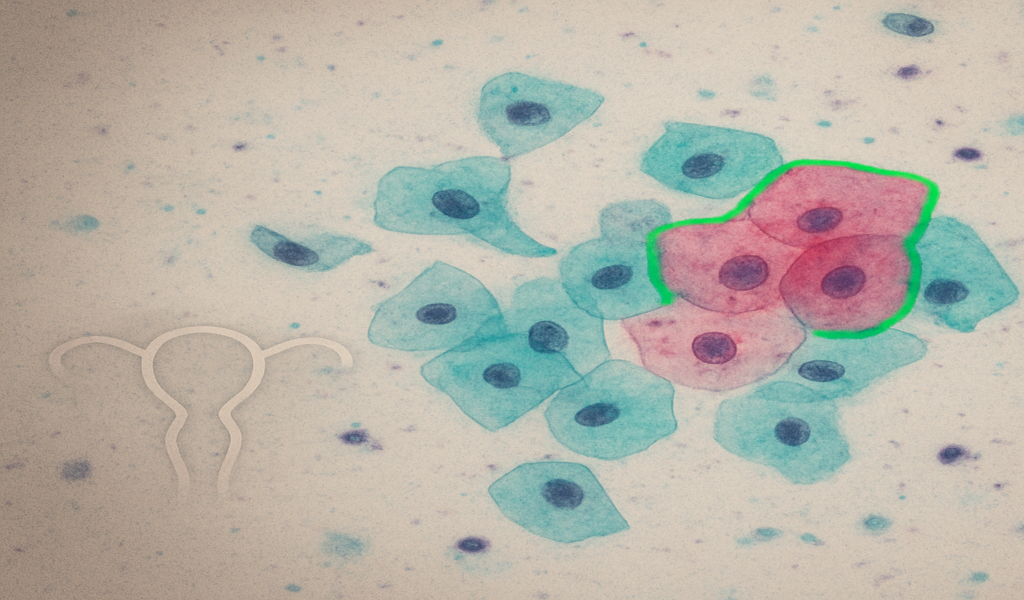 cervixpapsmear AI