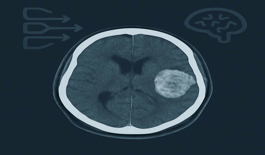 NeuroScan AI