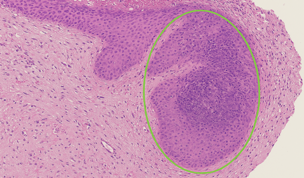 OralHisto AI